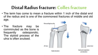 Distal Radius fracture: Colles fracture
• The term has come to mean a fracture within 1 inch of the distal end
of the radius and is one of the commonest fractures of middle and old
age.
• The fracture may be
comminuted as the bone is
frequently osteoporotic.
The styloid process of the
ulna is often avulsed.
 