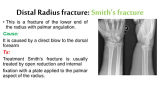 Distal Radius fracture: Smith’s fracture
• This is a fracture of the lower end of
the radius with palmar angulation.
Cause:
It is caused by a direct blow to the dorsal
forearm
Tx:
Treatment Smith’s fracture is usually
treated by open reduction and internal
fixation with a plate applied to the palmar
aspect of the radius.
 