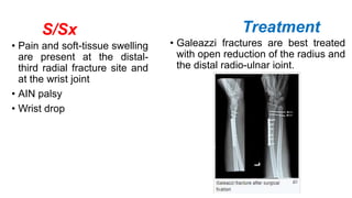S/Sx
• Pain and soft-tissue swelling
are present at the distal-
third radial fracture site and
at the wrist joint
• AIN palsy
• Wrist drop
Treatment
• Galeazzi fractures are best treated
with open reduction of the radius and
the distal radio-ulnar joint.
 