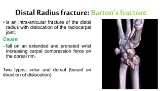 Distal Radius fracture: Barton’s fracture
• is an intra-articular fracture of the distal
radius with dislocation of the radiocarpal
joint.
Cause:
- fall on an extended and pronated wrist
increasing carpal compression force on
the dorsal rim.
Two types: volar and dorsal (based on
direction of dislocation)
 