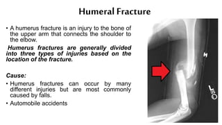 Humeral Fracture
• A humerus fracture is an injury to the bone of
the upper arm that connects the shoulder to
the elbow.
Humerus fractures are generally divided
into three types of injuries based on the
location of the fracture.
Cause:
• Humerus fractures can occur by many
different injuries but are most commonly
caused by falls.
• Automobile accidents
 