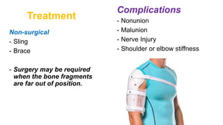 Treatment
Non-surgical
- Sling
- Brace
- Surgery may be required
when the bone fragments
are far out of position.
Complications
- Nonunion
- Malunion
- Nerve Injury
- Shoulder or elbow stiffness
 