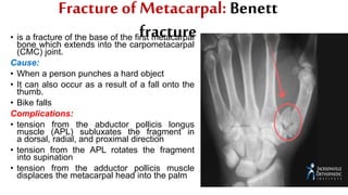 Fracture of Metacarpal: Benett
fracture• is a fracture of the base of the first metacarpal
bone which extends into the carpometacarpal
(CMC) joint.
Cause:
• When a person punches a hard object
• It can also occur as a result of a fall onto the
thumb.
• Bike falls
Complications:
• tension from the abductor pollicis longus
muscle (APL) subluxates the fragment in
a dorsal, radial, and proximal direction
• tension from the APL rotates the fragment
into supination
• tension from the adductor pollicis muscle
displaces the metacarpal head into the palm
 