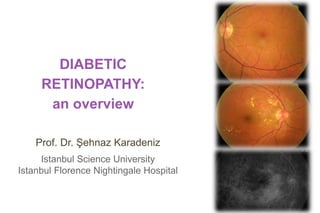 DIABETIC
RETINOPATHY:
an overview
Prof. Dr. Şehnaz Karadeniz
Istanbul Science University
Istanbul Florence Nightingale Hospital
 