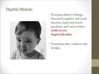 Psychic Moans:
• Neuropsychiatric: lethargy,
decreased cognitive and social
function, depressed mood,
psychosis, and coma in those
with severe
hypercalcemia.
• Neuromuscular: weakness and
myalgia
 