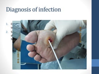 Diagnosis of infection
1. Classic signs of inflammation (redness, warmth, swelling,
tenderness, or pain or purulent secretions,
2. Secondary signs (eg, nonpurulent secretions, friable or
discolored granulation tissue, undermining of wound edges,
foul odor)
 