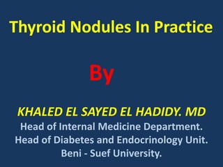 KHALED EL SAYED EL HADIDY. MD
Head of Internal Medicine Department.
Head of Diabetes and Endocrinology Unit.
Beni - Suef University.
Thyroid Nodules In Practice
By
 