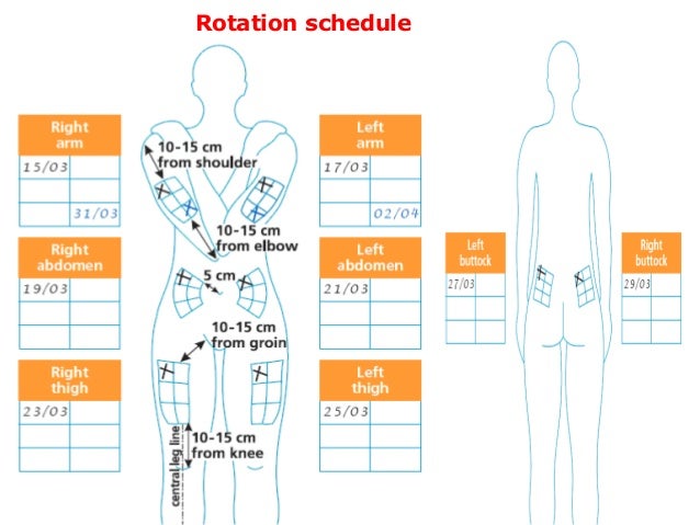 Insulin Injection Sites Diagram Printable prntbl Insulin Injection Sites Diagram Printable prntbl