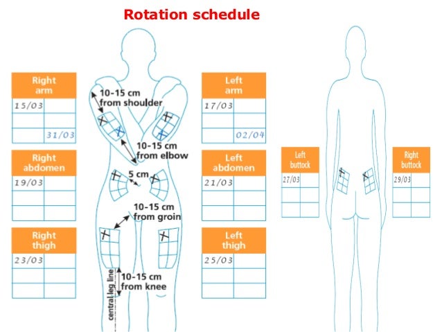 Insulin Injection Site Chart