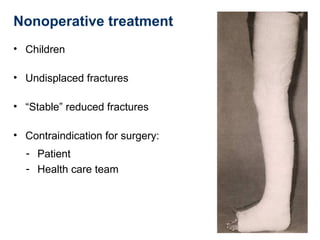 Nonoperative treatment
• Children
• Undisplaced fractures
• “Stable” reduced fractures
• Contraindication for surgery:
- Patient
- Health care team
 