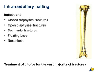 Intramedullary nailing
Indications
• Closed diaphyseal fractures
• Open diaphyseal fractures
• Segmental fractures
• Floating knee
• Nonunions
Treatment of choice for the vast majority of fractures
 