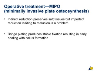 Operative treatment—MIPO
(minimally invasive plate osteosynthesis)
• Indirect reduction preserves soft tissues but imperfect
reduction leading to malunion is a problem
• Bridge plating produces stable fixation resulting in early
healing with callus formation
 