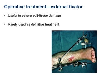 Operative treatment—external fixator
• Useful in severe soft-tissue damage
• Rarely used as definitive treatment
 