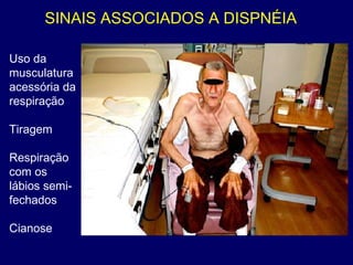 SINAIS ASSOCIADOS A DISPNÉIA
Uso da
musculatura
acessória da
respiração
Tiragem
Respiração
com os
lábios semi-
fechados
Cianose
 