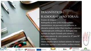 Contos
o
Farmacêutica
Contoso
• DIAGNÓSTICO –
RADIOGRAFIAAO TÓRAX:
Exames de imagem :
Radiografia ao tórax pode revelar achados
característicos, em pacientes com enfisema, as
alterações podem incluir Hiper insuflação pulmonar
manifestada pela retificação do diafragma com
aumento do ângulo formado pelo esterno e
diafragma anterior do valor normal de 45º para 90º
na incidência lateral.
Outros achados típicos incluem aumento do espaço
aéreo retro esternal e uma sombra cardíaca estreita.
página 11
 