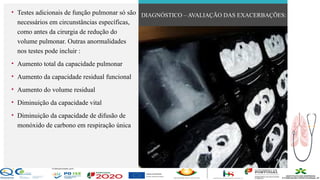 Contos
o
Farmacêutica
Contoso
• Testes adicionais de função pulmonar só são
necessários em circunstâncias específicas,
como antes da cirurgia de redução do
volume pulmonar. Outras anormalidades
nos testes pode incluir :
• Aumento total da capacidade pulmonar
• Aumento da capacidade residual funcional
• Aumento do volume residual
• Diminuição da capacidade vital
• Diminuição da capacidade de difusão de
monóxido de carbono em respiração única
DIAGNÓSTICO – AVALIAÇÃO DAS EXACERBAÇÕES:
página 18
 