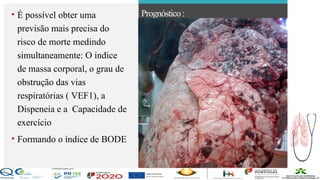 Contos
o
Farmacêutica
Contoso
• É possível obter uma
previsão mais precisa do
risco de morte medindo
simultaneamente: O índice
de massa corporal, o grau de
obstrução das vias
respiratórias ( VEF1), a
Dispeneia e a Capacidade de
exercício
• Formando o índice de BODE
Prognóstico:
página 20
 