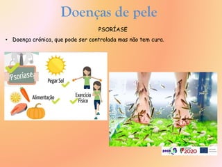 PSORÍASE
• Doença crónica, que pode ser controlada mas não tem cura.
Doenças de pele
 