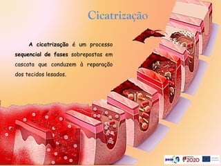 A cicatrização é um processo
sequencial de fases sobrepostas em
cascata que conduzem à reparação
dos tecidos lesados.
Cicatrização
 