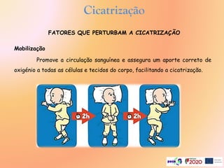 Mobilização
Promove a circulação sanguínea e assegura um aporte correto de
oxigénio a todas as células e tecidos do corpo, facilitando a cicatrização.
FATORES QUE PERTURBAM A CICATRIZAÇÃO
Cicatrização
 