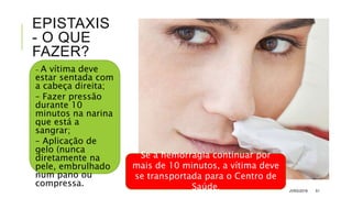 EPISTAXIS
- O QUE
FAZER?
- A vítima deve
estar sentada com
a cabeça direita;
– Fazer pressão
durante 10
minutos na narina
que está a
sangrar;
– Aplicação de
gelo (nunca
diretamente na
pele, embrulhado
num pano ou
compressa.
JVRS/2018 51
Se a hemorragia continuar por
mais de 10 minutos, a vítima deve
se transportada para o Centro de
Saúde.
 