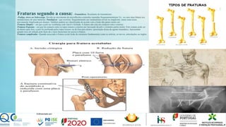 Fraturas segundo a causa: -Traumáticas: Resultante de traumatismo.
-Fadiga, stress ou Sobrecarga. Devido ao movimento de microflexões-extensões repetidas frequentemente(por Ex., no caso uma fratura nos
metatarsianso de uma bailarina. Patológicas - que ocorrem, frequentemente por traumatismo trivial ou inaparente, numa zona óssea
previamente fragilizada por doença. Também podem ser classificadas de acordo com a lesão das partes moles em :
Fraturas Simples – em que a pele na vizinhança está viável e fechada. A fratura não está em contacto com o exterior.
Fraturas Expostas – em que há contacto entre os topos ósseos e exterior por laceração da pele e restantes partes moles. Este contato pode ser
de dentro para fora, a pele foi perfurada pelos topos ósseos- ou de fora para dentro- penetração direta do agente traumático. Apresentam
grande risco de infeção pelo facto de o meio bacteriano ter acesso á fratura.
Fraturas complicadas –Quando associado à fratura existe lesão de estruturas fundamentais como as artérias, os nervos, articulações ou órgãos.
 