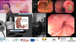 A Mecânica e Eliminação Intestinal: No
contexto hospitalar as pessoas ficam ansiosas frequentemente em relação á necessidade de
defecar.
A necessidade de uma defecação regular tem sido levada ao extremo por muitos. A
maioria das pessoas leigas tem a ideia errada que evacuar diariamente é essencial para a
saúde.
O conceito de obstipação é correto apenas quando se refere a ocorrência de emissão de
fezes igual ou inferior a duas vezes por semana. Os doentes internados na sua maioria
limitados ao leito, alimentando-se de menor quantidade de comida e com uma grande
limitação na mobilidade, terão um menor ritmo de defecação. Devido á falta de
movimentação, diminuindo os reflexos associados aos movimentos do intestino grosso ,
essenciais á ocorrência de dejeção.
11
 