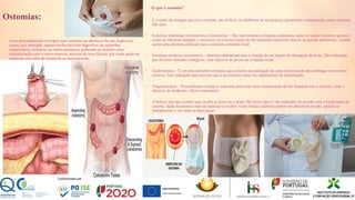 Ostomias:
• é um procedimento cirúrgico que consiste na abertura de um órgão oco
como, por exemplo, algum trecho do tubo digestivo, do aparelho
respiratório, urinário, ou outro qualquer, podendo ou manter uma
comunicação com o meio externo, através de uma fístula, por onde pode-se
conectar um tubo de inspeção ou manutenção.
O que é estomia?
• É o nome da cirurgia que cria o estoma, um orifício, no abdômen ou na traqueia, permitindo comunicação com o exterior.
São elas:
• Estomias Intestinais (colostomia e ileostomia) – São intervenções cirúrgicas realizadas, tanto no cólon (intestino grosso)
como no intestino delgado e consistem na exteriorização de um segmento intestinal através da parede abdominal, criando
assim uma abertura artificial para a saída do conteúdo fecal.
• Estomias urinárias (urostomia) – Abertura abdominal para a criação de um trajeto de drenagem da urina. São realizadas
por diversos métodos cirúrgicos, com objetivo de preservar a função renal.
• Gastrostomia – É um procedimento cirúrgico que consiste na realização de uma comunicação do estômago com o meio
exterior. Tem indicação para pessoas que a necessitam como via suplementar de alimentação.
• Traqueostomia – Procedimento cirúrgico realizada para criar uma comunicação da luz traqueal com o exterior, com o
objetivo de melhorar o fluxo respiratório.
• A bolsa é um saco coletor que recebe as fezes ou a urina. Há vários tipos e são indicados de acordo com a localização do
estoma, idade da pessoa e tipo de material a receber. Essas bolsas coletoras podem ser drenáveis ou não, opacas ou
transparentes e em uma ou duas peças
 