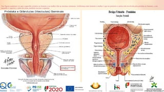 Nas figuras podemos ver que o aparelho urinário no homem e na mulher têm as mesmas estruturas. A diferença entre homem e mulher é que no primeiro a uretra está envolvida pela próstata no homem, o seu
tamanho é superior, e além da urina, também excreta o esperma.
25
 