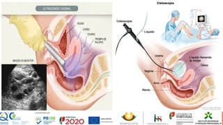 Adicione um Título de
Diapositivo – 1
 
