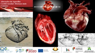 Alterações do Aparelho
Cardiovascular- Doenças mais
Comuns:
▪ Os hábitos de vida da nossa sociedade, como o sedentarismo (pouca
atividade física), a dieta rica em gorduras(colesterol), o stress e os
hábitos tabágicos e alcoólicos, são os grandes responsáveis pelo
aparecimento e desenvolvimento de doenças cardiovasculares.
 