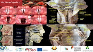 Vias Aéreas Superiores:
 