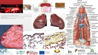 Pulmões e sua Função:
O ser humano tem dois pulmões, um de cada lado, no tórax (peito), ligados um ao outro através de tubos que vão
desde o nariz, faringe, laringe, traqueia, brônquios, bronquíolos.
Os pulmões ocupam uma grande parte da cavidade torácica(tórax-peito), que é separada da cavidade abdominal
pelo diafragma (músculo)
Os pulmões estão dentro de um “saco duplo” que é a pleura, que recobre cada pulmão.
Existem 2 pleuras: Pleura Visceral e a Pleura Parietal.
 