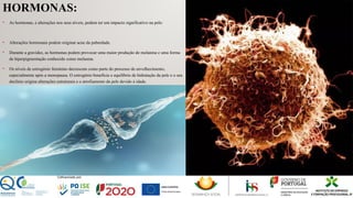 HORMONAS:
• As hormonas, e alterações nos seus níveis, podem ter um impacto significativo na pele:
• Alterações hormonais podem originar acne da puberdade.
• Durante a gravidez, as hormonas podem provocar uma maior produção de melanina e uma forma
de hiperpigmentação conhecido como melasma.
• Os níveis de estrogénio feminino decrescem como parte do processo de envelhecimento,
especialmente após a menopausa. O estrogénio beneficia o equilíbrio de hidratação da pele e o seu
declínio origina alterações estruturais e o atrofiamento da pele devido à idade.
 
