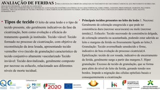 AVALIAÇÃO DE FERIDAS :PARAA ESCOLHA DA COBERTURAADEQUADA NO TRATAMENTO DE UMA FERIDA É ESSENCIAL QUE PREVIAMENTE OCORRA UMA
AVALIAÇÃO CRITERIOSA. AANÁLISE DA LESÃO DEVE
INCLUIR, ALÉM DAS CONDIÇÕES FÍSICAS E SISTÊMICAS, A LOCALIZAÇÃO ANATÔMICA DA FERIDA E SUAS CARACTERÍSTICAS, COMO: FORMA, TAMANHO, PROFUNDIDADE, MARGENS, PELE PERFIL
LESIONAL, TIPO E QUANTIDADE DE TECIDO E PRESENÇA CARACTERÍSTICAS DO EXSUDATO NA FERIDA. APÓS ESSAAVALIAÇÃO É FEITAA ESCOLHA DA COBERTURA IDEAL. (ODA, SALOTTI,
GUIMARÃES, 2011)
• Tipos de tecido O leito de uma lesão e o tipo de
tecido presente, são geralmente indicativos da fase da
cicatrização, bem como evolução e eficácia do
tratamento quando já instituído. Tecido viável: Tecido
formado no processo de cicatrização, com objetivo de
reconstituição da área lesada, apresentando tecido
vermelho vivo (tecido de granulação) característico de
tecido conjuntivo altamente vascularizado Tecido
inviável: Tecido desvitalizado, geralmente composto
por necrose ou esfacelo, relacionado aos diferentes
níveis de morte tecidual.
• Principais tecidos presentes no leito da lesão:1. Necrose:
Geralmente de coloração enegrecida e que pode ter
consistência dura (necrose seca/escara) ou mole (necrose
úmida);2. Esfacelo: Tecido necrosado de consistência delgada,
de coloração amarela ou acastanhada, podendo estar aderida ao
leito e margens da ferida ou frouxamente ligada ao leito;3.
Granulação: Tecido avermelhado umedecido e firme,
indicativo de boa evolução do processo cicatricial;4.
Epitelização: tecido de cor rosada, indicativo de encerramento
da ferida, geralmente surge a partir das margens.5. Hiper
granulação: Excesso de tecido de granulação, que se forma
para além do nível do leito da ferida, gerando tensão nos
bordos. Impede a migração das células epiteliais basais e
consequentemente a cicatrização
 
