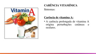 CARÊNCIA VITAMÍNICA
Sintomas:
Carência de vitamina A:
• A carência prolongada de vitamina A
origina perturbações cutâneas e
oculares.
 