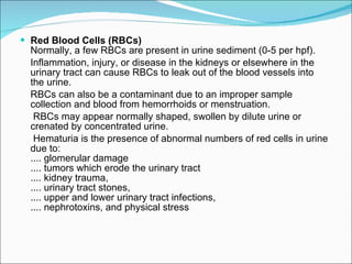Red Blood Cells (RBCs)   Normally, a few RBCs are present in urine sediment (0-5 per hpf). Inflammation, injury, or disease in the kidneys or elsewhere in the urinary tract can cause RBCs to leak out of the blood vessels into the urine.  RBCs can also be a contaminant due to an improper sample collection and blood from hemorrhoids or menstruation.   RBCs may appear normally shaped, swollen by dilute urine or crenated by concentrated urine.    Hematuria is the presence of abnormal numbers of red cells in urine due to: .... glomerular damage .... tumors which erode the urinary tract .... kidney trauma, .... urinary tract stones, .... upper and lower urinary tract infections, .... nephrotoxins, and physical stress 