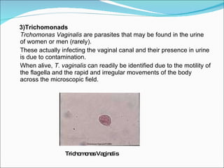 3)Trichomonads   Trchomonas Vaginalis  are parasites that may be found in the urine of women or men (rarely). These actually infecting the vaginal canal and their presence in urine is due to contamination. When alive,  T. vaginalis  can readily be identified due to the motility of the flagella and the rapid and irregular movements of the body across the microscopic field. Trichomonas Vaginalis 