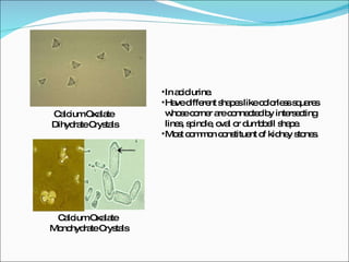Calcium Oxalate  Dihydrate Crystals Calcium Oxalate  Monohydrate Crystals In acid urine. Have different shapes like colorless squares whose corner are connected by intersecting lines, spindle, oval or dumbbell shape. Most common constituent of kidney stones.  