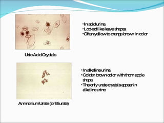 Uric Acid Crystals Ammonium Urate (or Biurate) In acid urine. Looked like leave shapes. Often yellow to orange-brown in color In alkaline urine. Golden brown color with thorn apple shape. The only urate crystals appear in alkaline urine 
