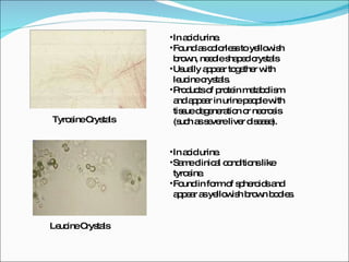 Leucine Crystals Tyrosine Crystals In acid urine. Found as colorless to yellowish brown, needle shaped crystals Usually appear together with leucine crystals. Products of protein metabolism and appear in urine people with tissue degeneration or necrosis (such as severe liver disease). In acid urine. Same clinical conditions like tyrosine. Found in form of spheroids and appear as yellowish brown bodies. 
