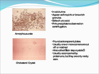 Test urine feme Urinalysis