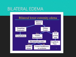 BILATERAL EDEMA
 