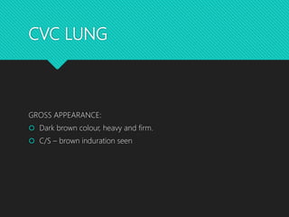 CVC LUNG
GROSS APPEARANCE:
 Dark brown colour, heavy and firm.
 C/S – brown induration seen
 