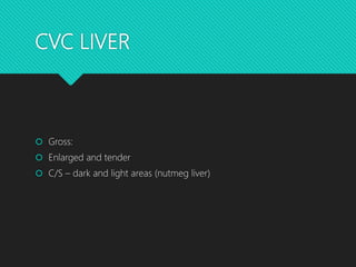 CVC LIVER
 Gross:
 Enlarged and tender
 C/S – dark and light areas (nutmeg liver)
 