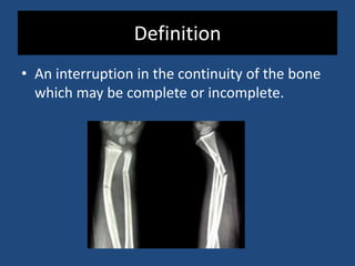 Principles of management of Fractures | PPTX