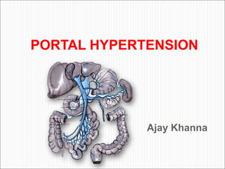 Ajay Khanna
PORTAL HYPERTENSION
x
 