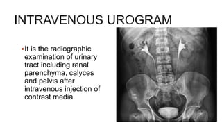 It is the radiographic
examination of urinary
tract including renal
parenchyma, calyces
and pelvis after
intravenous injection of
contrast media.
 