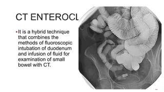 It is a hybrid technique
that combines the
methods of fluoroscopic
intubation of duodenum
and infusion of fluid for
examination of small
bowel with CT.
 