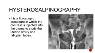 It is a fluroscopic
procedure in which the
contrast is injected into
the uterus to study the
uterine cavity and
fallopian tubes.
 